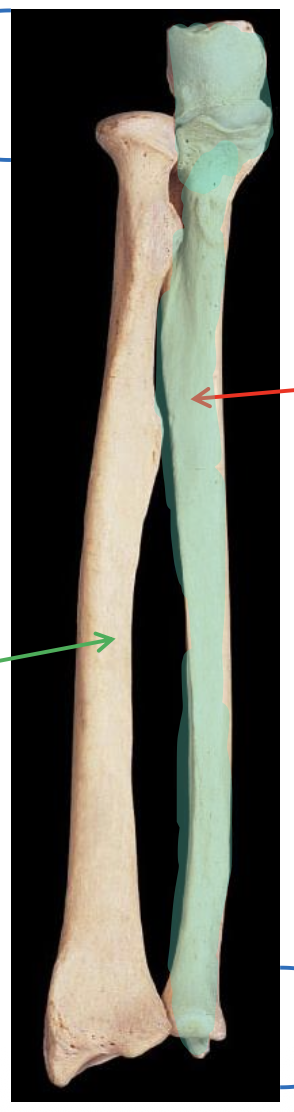 <p>In this image of the antebrachium, name the highlighted bone</p>