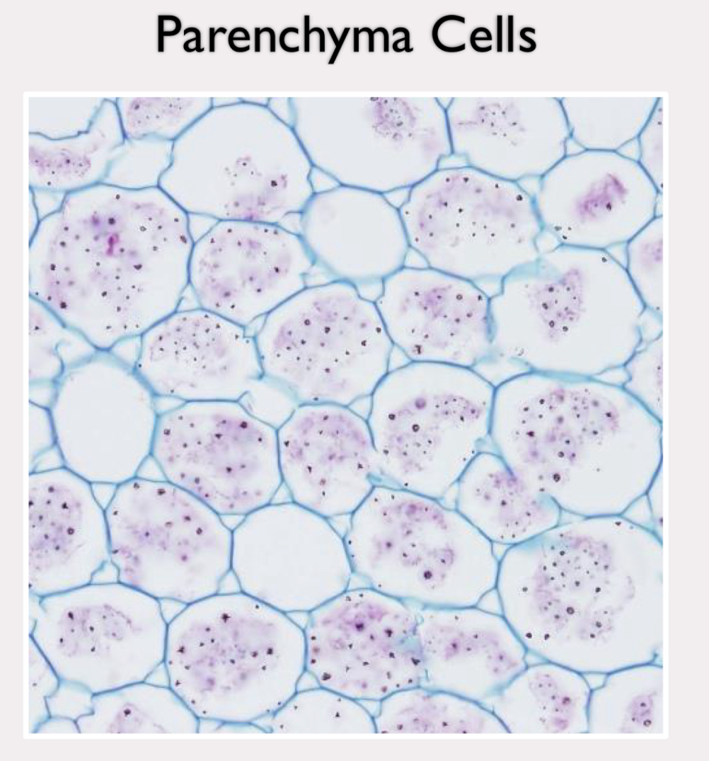 <p>least specialized</p><p>no secondary cell wall</p><p>thin primary cell wall</p><p>holds water and stores nutrients in large central vacuole</p><p>location of most metabolism to support plant</p>