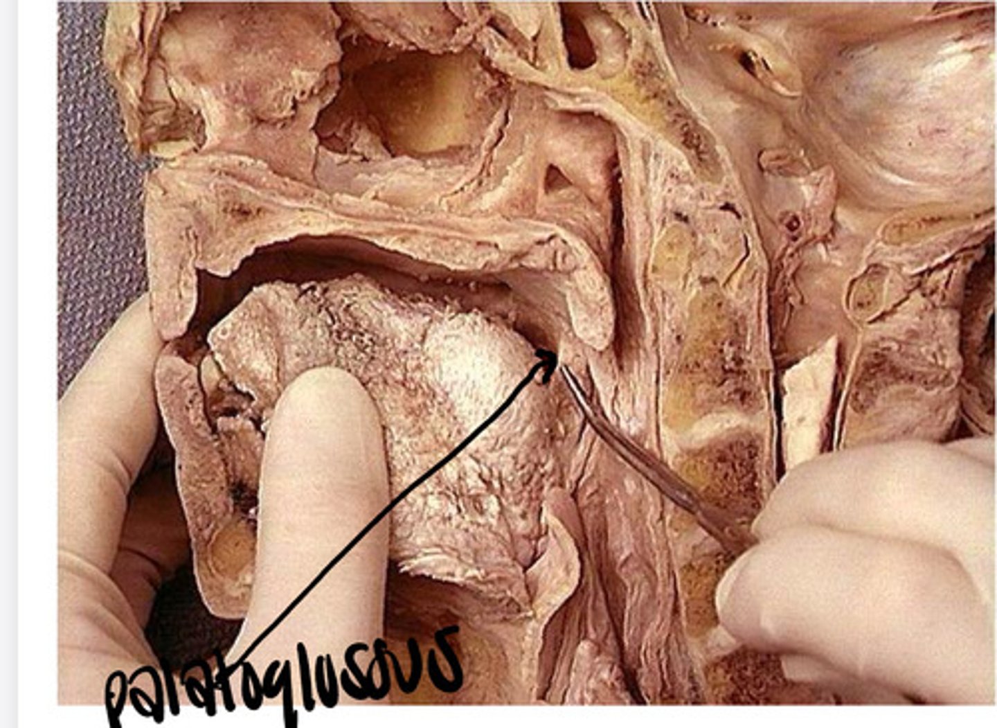 <p>muscle of the glossus &amp; soft palate that </p><p>    -elevates the tongue &amp; pulls down soft palate to seal the oropharynx</p><p>     - retraction of tongue &amp; depression of uvula to bring the soft palate &amp; tongue into contact</p><p>    -isolates vestibule saliva</p><p>    -prounciate velar consonants (K sound)</p><p>    -assists in swallowing</p><p><strong>*no bony attachment</strong></p><p>*innervated by Vagus Nerve (CN X) --&gt; (located near the uvula that's innervated by CN X too, so this makes sense)</p>