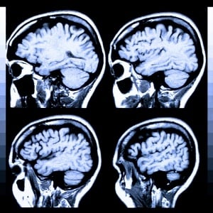 <p>Refined X-ray for problems in brain &amp; abdomen</p>