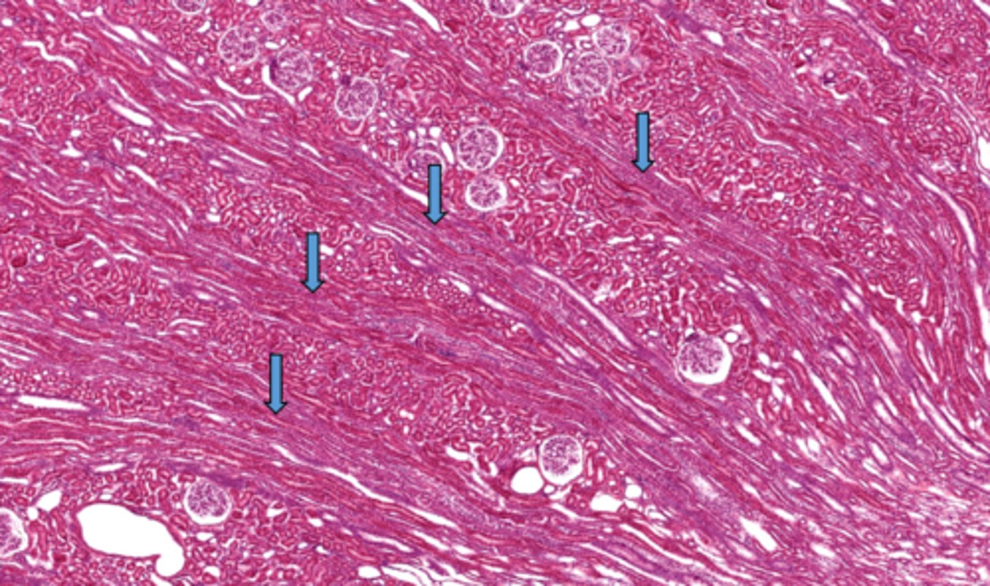 <p>Identify the collection of straight structures in the cortex of the kidney</p>