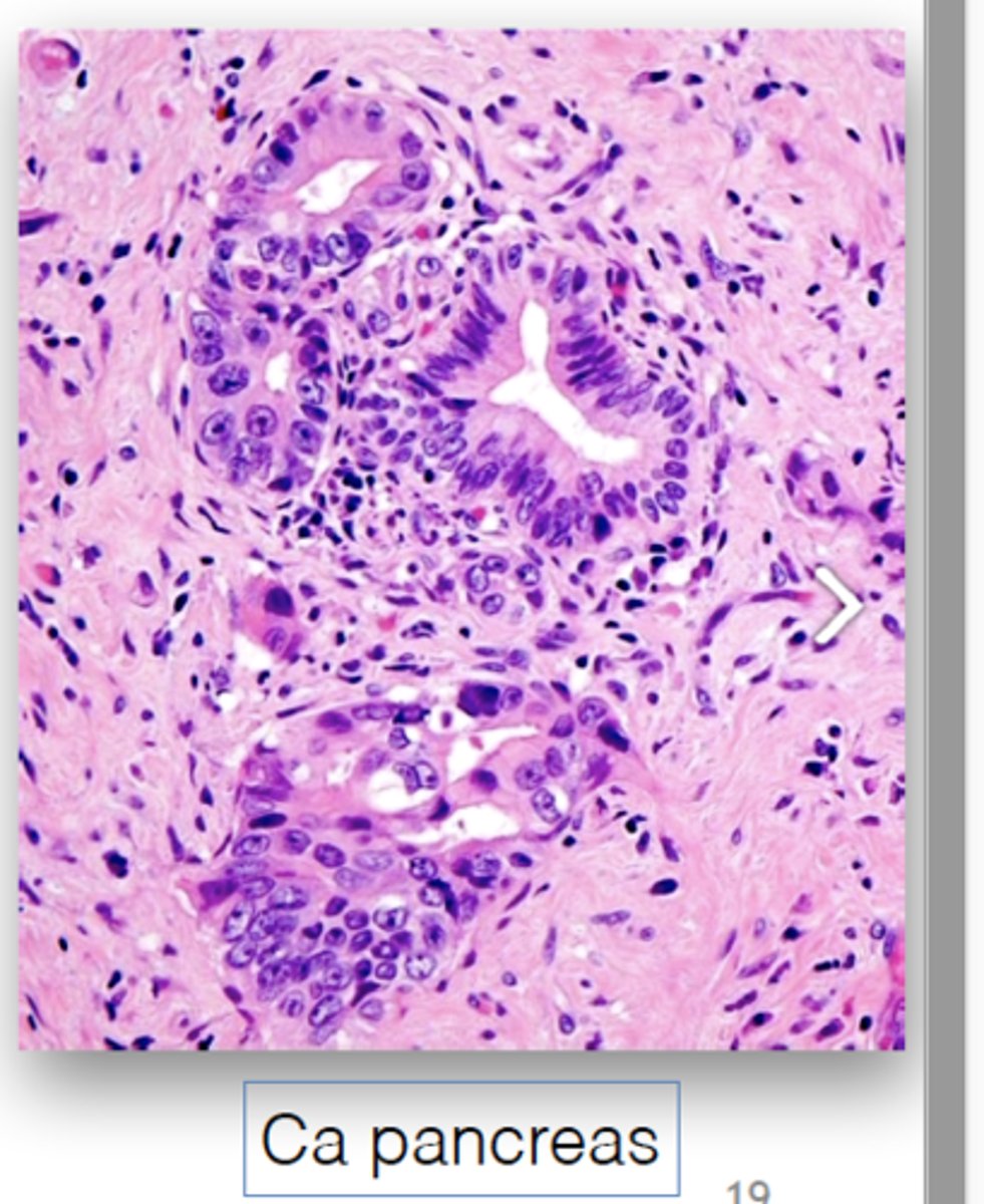 <p>cell goes into autocrine mode to stimulate its own activation and allows for uncontrolled proliferation</p>