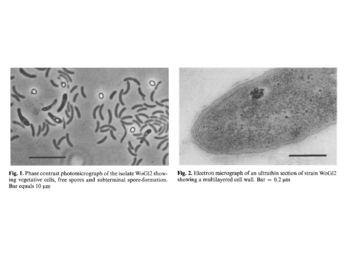 <p>Suggest Gram positives were once Gram negatives that lost their OM and thickened peptidoglycan because of horizontal gene transfer.</p>