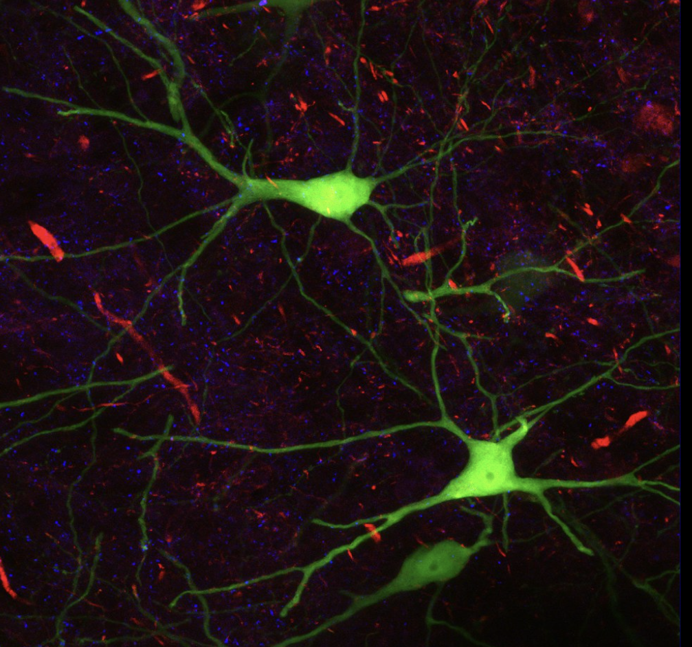 <p>Confocal Microscopy</p>