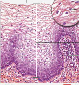 <p>found where mechanical stresses are severe</p><p>keratinized - skin (tough, water resistant)</p><p>nonkeratinized - mouth, throat, rectum, anus, vagina</p>