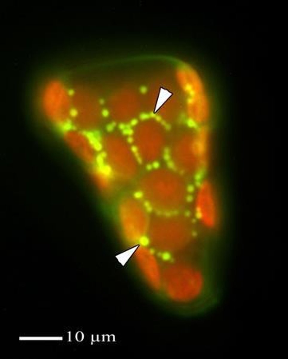 <p>Red chloroplasts.</p>