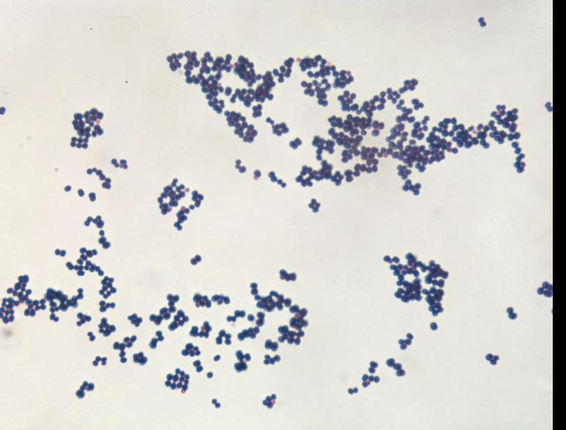 <p>What is this type of grouping called</p>