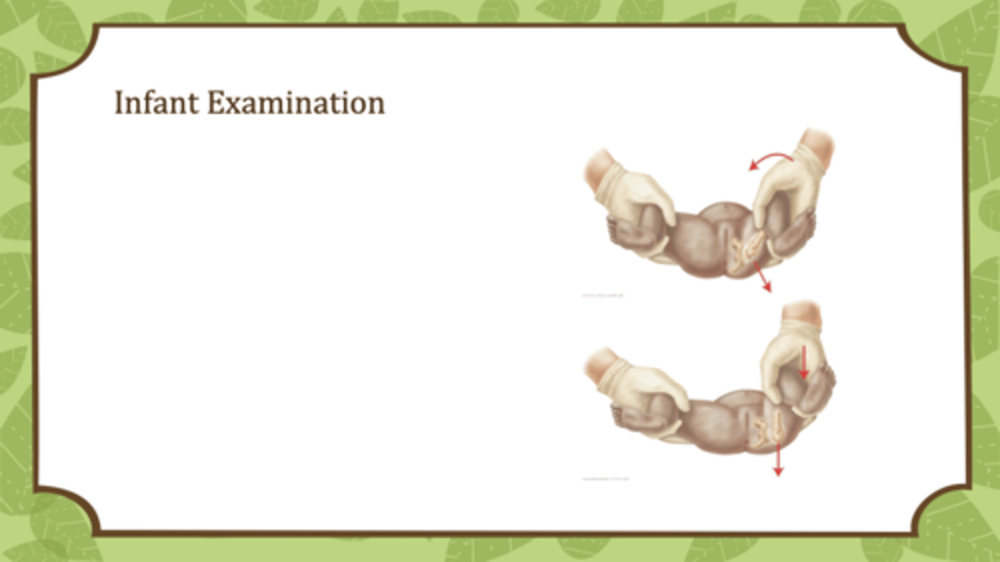 <p>•Place your index/middle fingers over greater trochanter and your thumbs over the lesser trochanter</p><p>•Adduct the legs at a 90 degree angle with gentle posterior force applied to hips</p><p>•Assess the ability to sublux or dislocate an intact but unstable hip</p><p>•No movement is NORMAL</p>