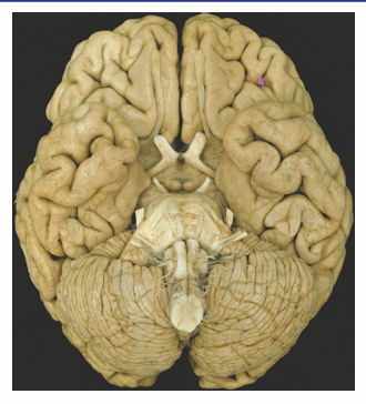 <p>Identify the gyri and their locations</p><p>straight</p><p>parahippocampal</p><p>uncus of parrahipocampal</p><p>inferior occipital</p><p>orbital</p><p>occipiatemporal/fusiform</p><p>inferior temporal</p><p>lingual</p>