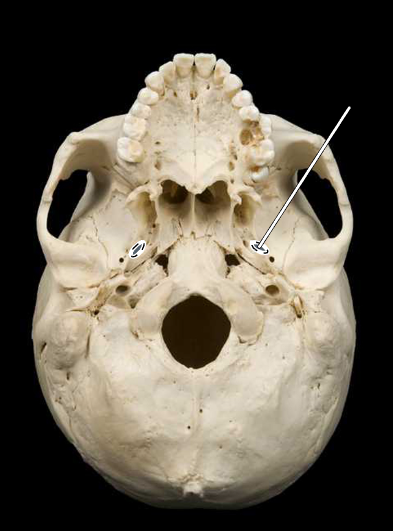 <p>Name the highlighted portion.</p><p>(Skull, inferior view).</p>