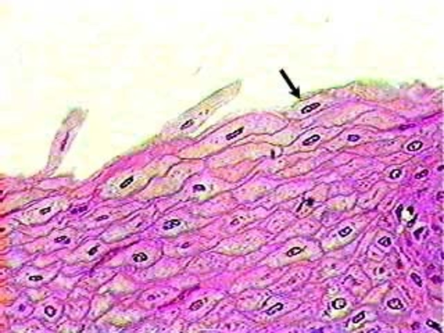 <p>epidermis</p><p>oral cavity</p><p>esophagus</p><p>vagina</p>