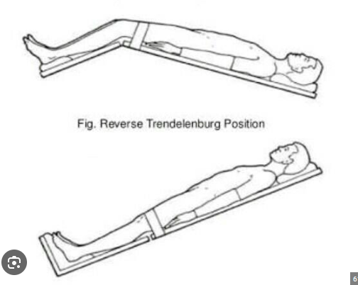 <p>What position is Trendelenburg and reverse Trendelenburg </p>