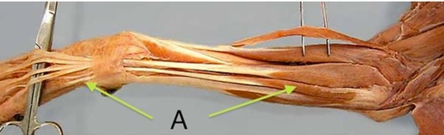 <p>What muscle is this?</p><p>Origin?</p><p>Insertion?</p><p>Action?</p><p>Nerve?</p>