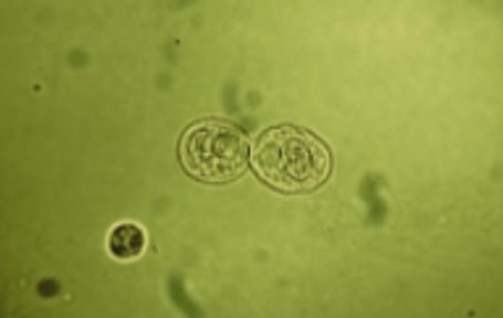 <p>name this cell? What is it associated with?</p>