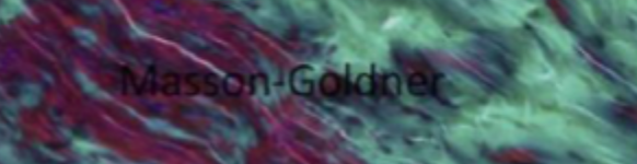 <p>Grøn eller rød</p>