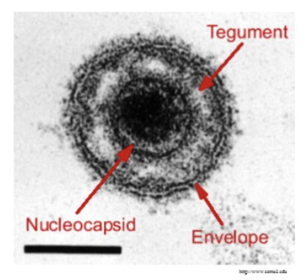 * DNA viruses
* productive (lytic) or latent (lysogeny) infections that last for life
* 3 families: alpha/beta/gamma
* distinguished from ea other by type of cells they exhibit latency in
* **icosahedral, enveloped, spiked,** ***tegment*** **(layer of proteins), dsDNA**