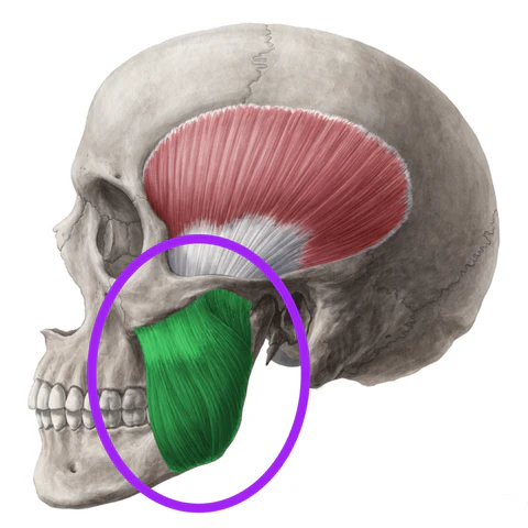 <p>Origin: zygomatic arch</p><p>Insertion: coronoid process, lateral surface and angle of mandible</p><p>Action: elevation and protraction of the jaw</p>