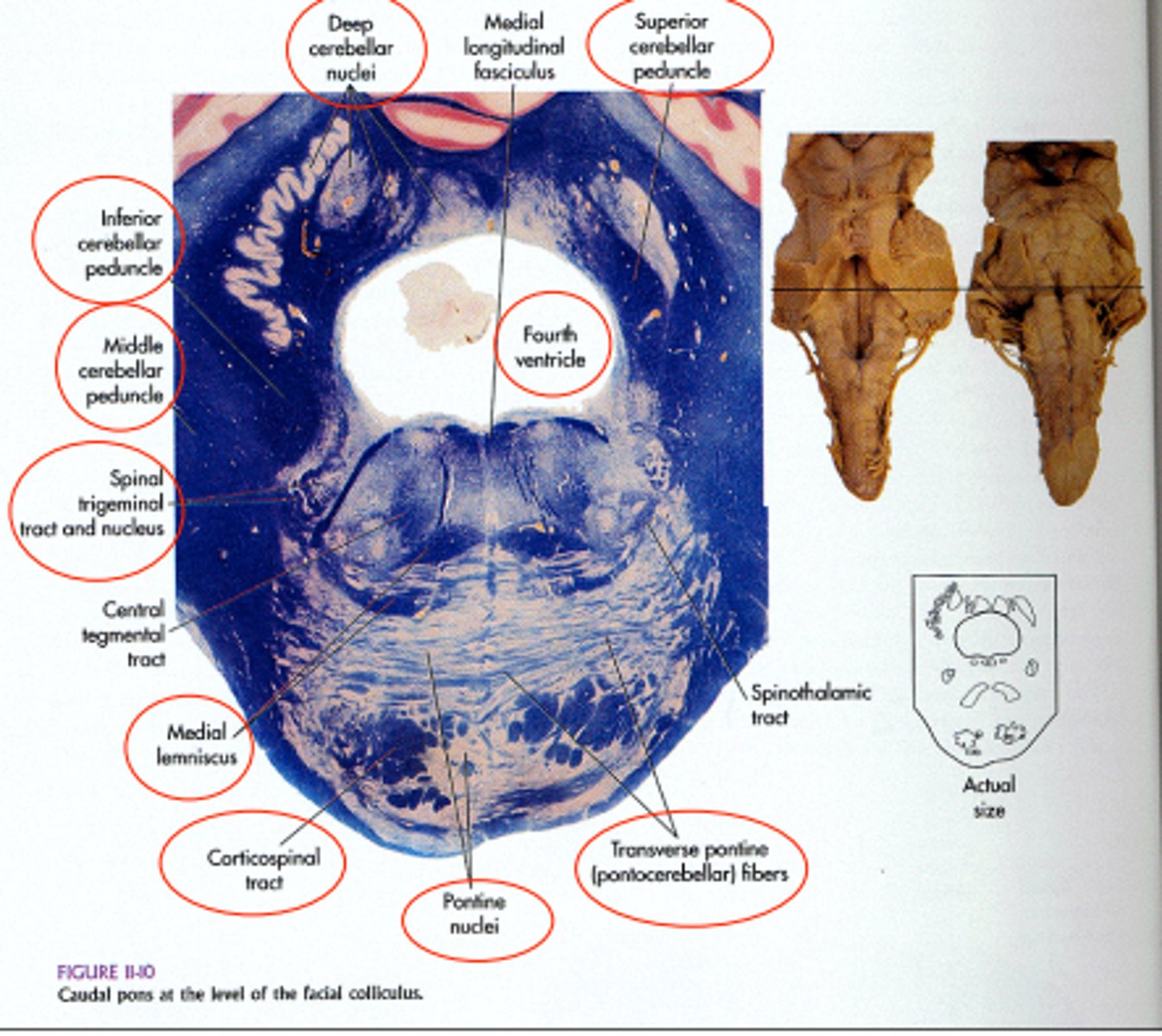 <p>Deep cerebellar nuclei were not included in brainstorm schematics, note where these are</p>