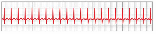 <p>What rhythm is this?</p>