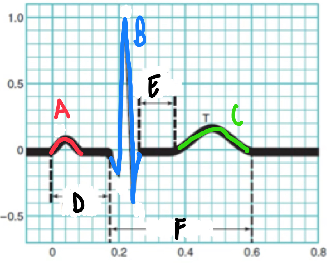 <p>Identify the different parts of an ECG in this diagram. </p>