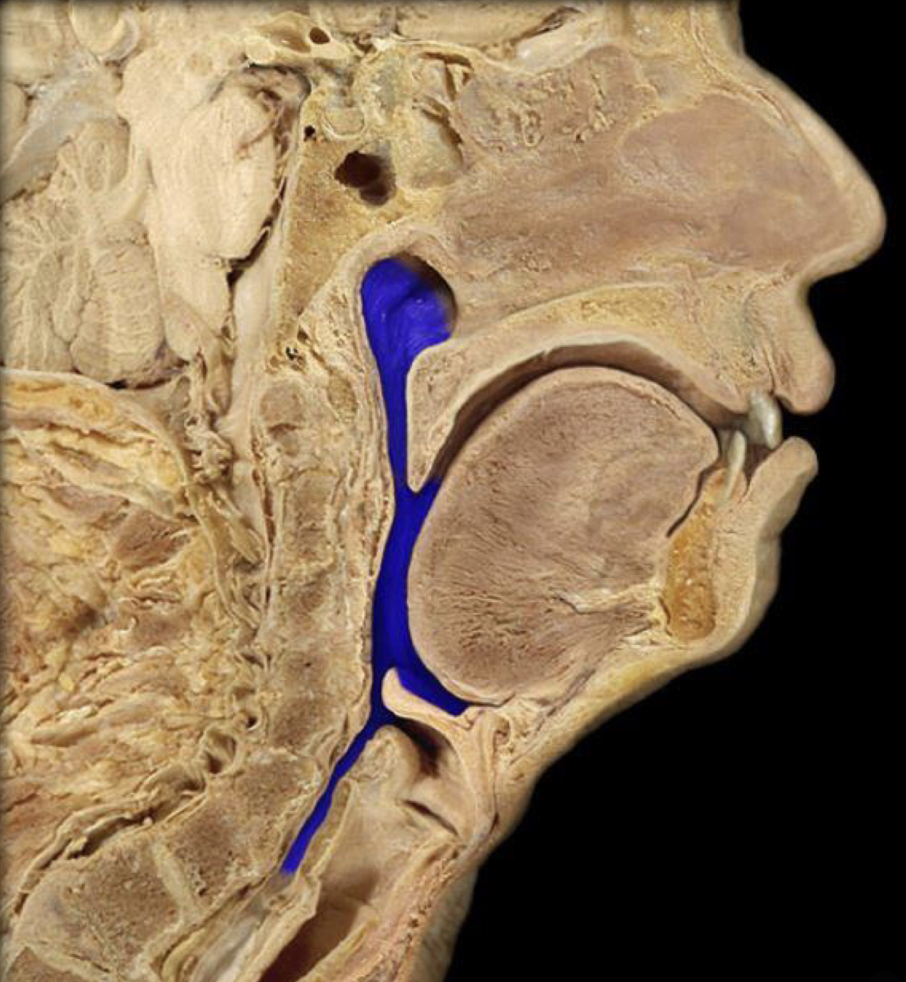 What structure is highlighted in blue?