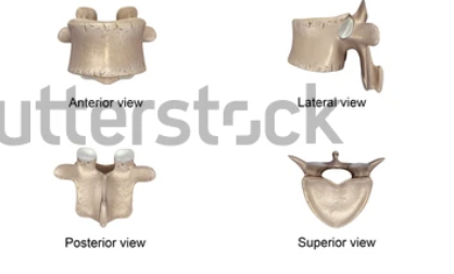 <p>Which spinal bone is this?</p>