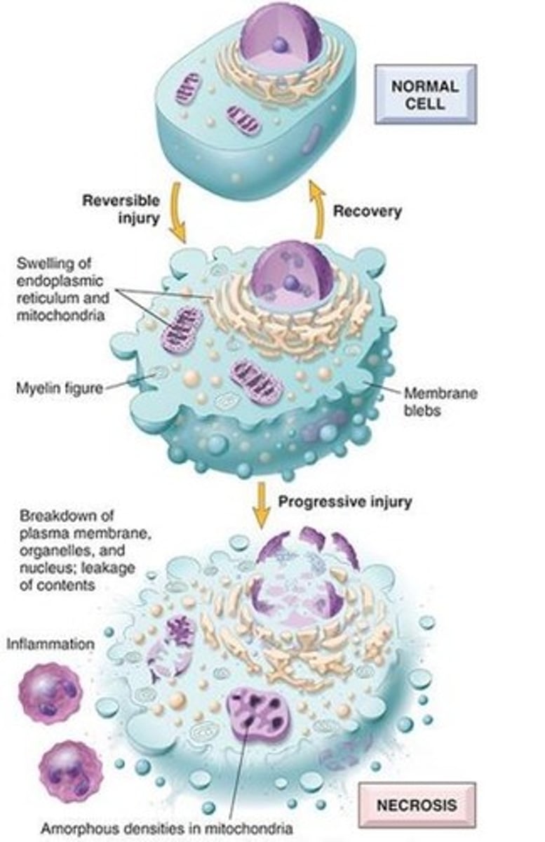 <p>1) Cell membranes = plasma membrane & organelle membrane</p><p>2) Nucleus = DNA</p><p>3) Proteins e.g., enzymes</p><p>4) Mitochondria = oxidative phosphorylation </p><p>In the irreversible cell injury example - there is breakdown of the plasma membrane, organelles and nucleus as well as leakage of contents. This is known as necrosis.</p>