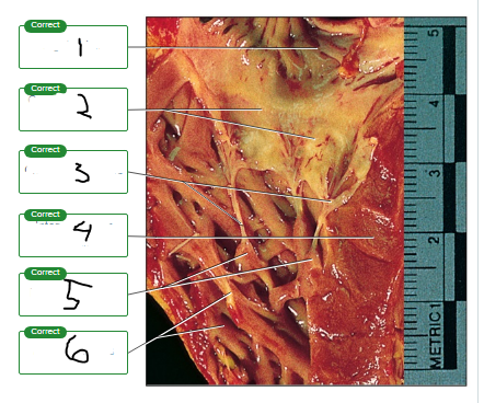 <p>Label the photograph of the tricuspid valve.</p><p><span style="font-size: inherit; font-family: inherit"><br></span></p>