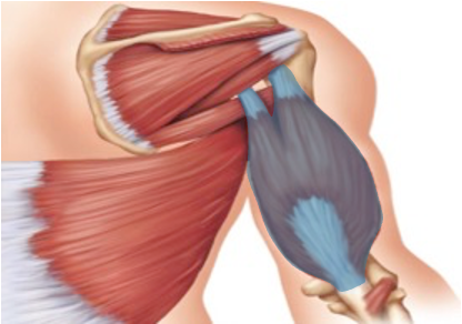 <p>What is the highlighted muscle?</p>