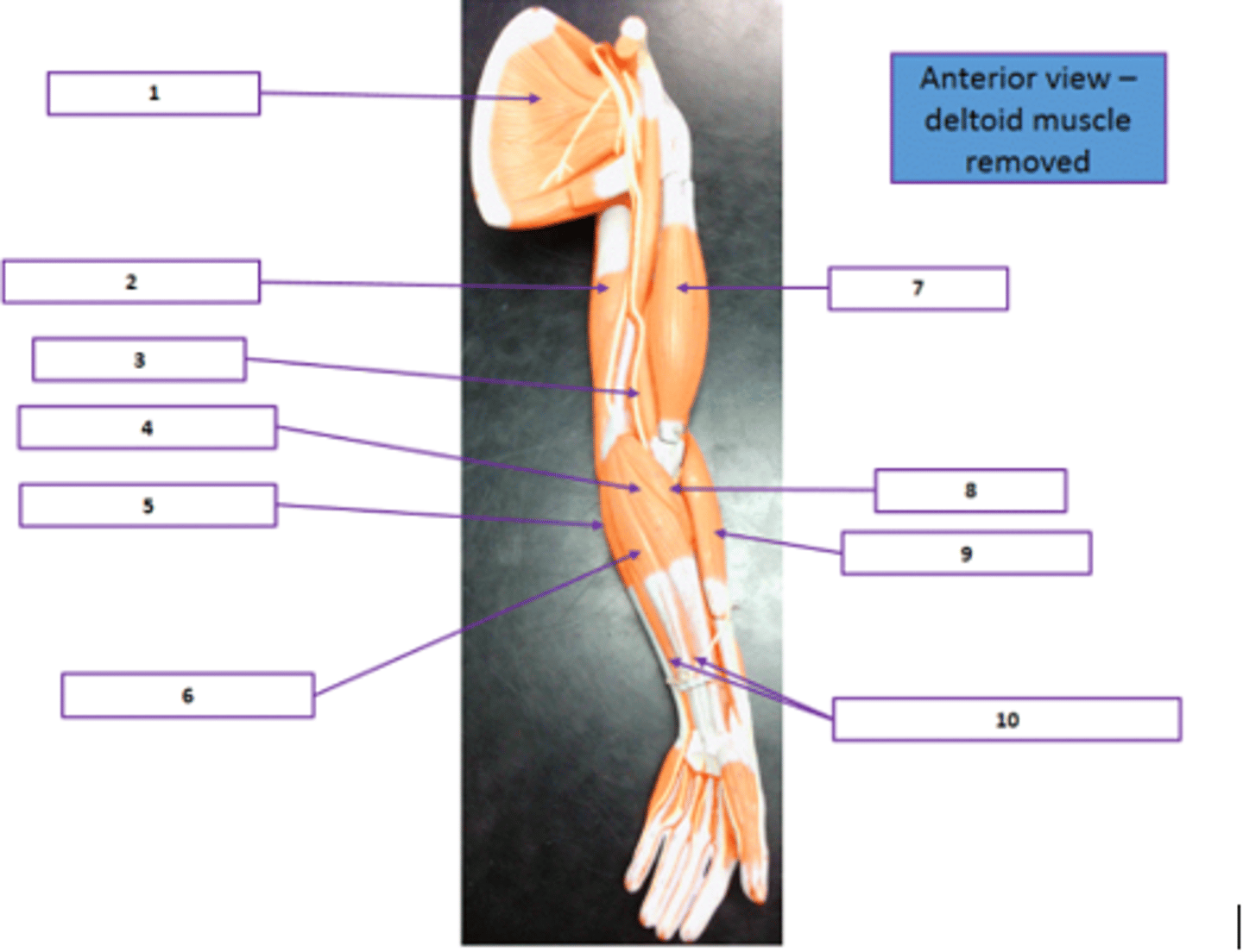 <p>Identify the muscle labeled 10.</p>