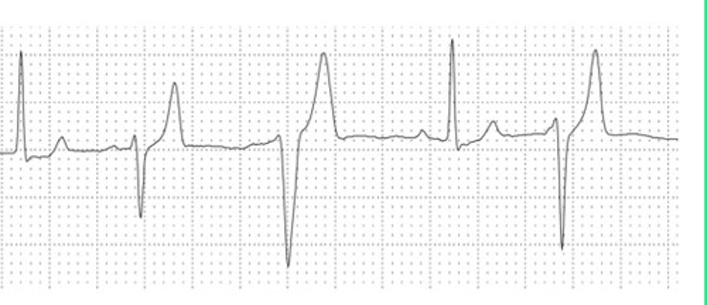 <p>What is the origin of this ECG?</p>