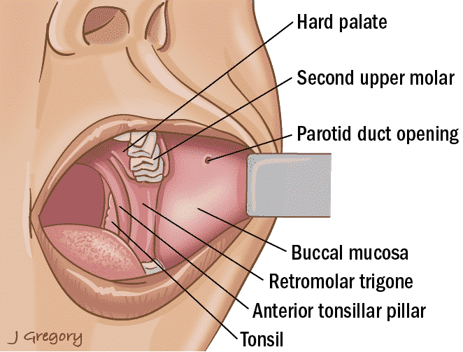 <p>Buccal</p>