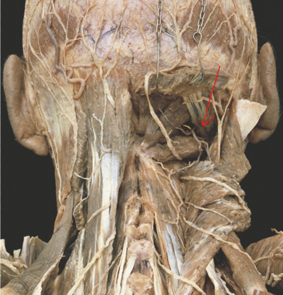 knowt flashcard image