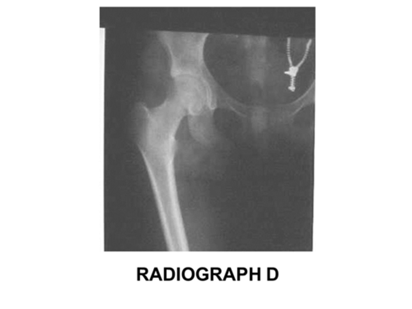 <p>Identify this projection:</p><p>AP femur</p><p>AP pelvis</p><p>AP hip</p><p>Modified Cleaves</p>