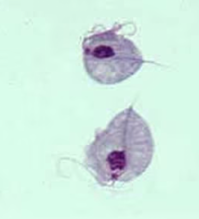 <p>Which urogenital protozoa is transmitted by <strong>sexual contact </strong>and causes <strong>trichomoniasis?</strong></p><ul><li><p>the most common protozoal urogenital tract infection of humans</p></li></ul>
