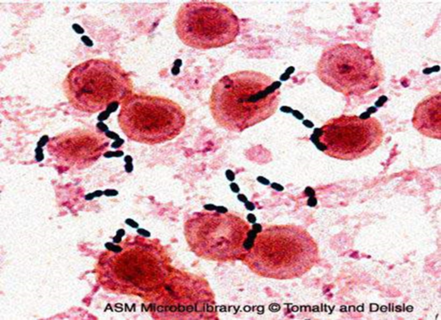 <p>Enterococcus faecium</p>