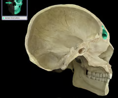 Cavity within a bone, filled with air and lined with mucous membrane