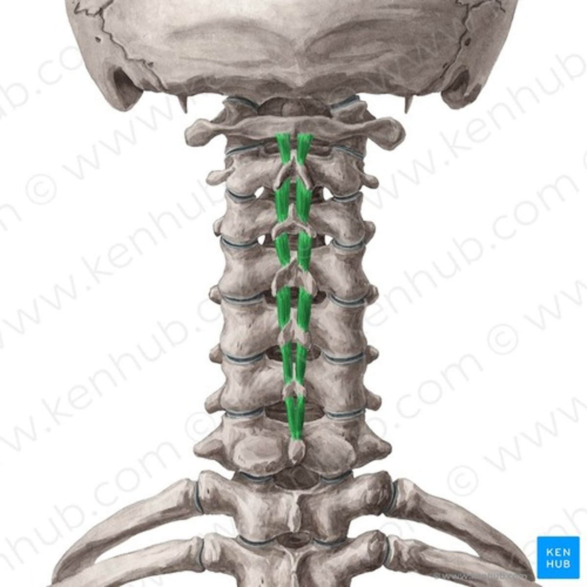 <p>Welke spier is dit?</p>