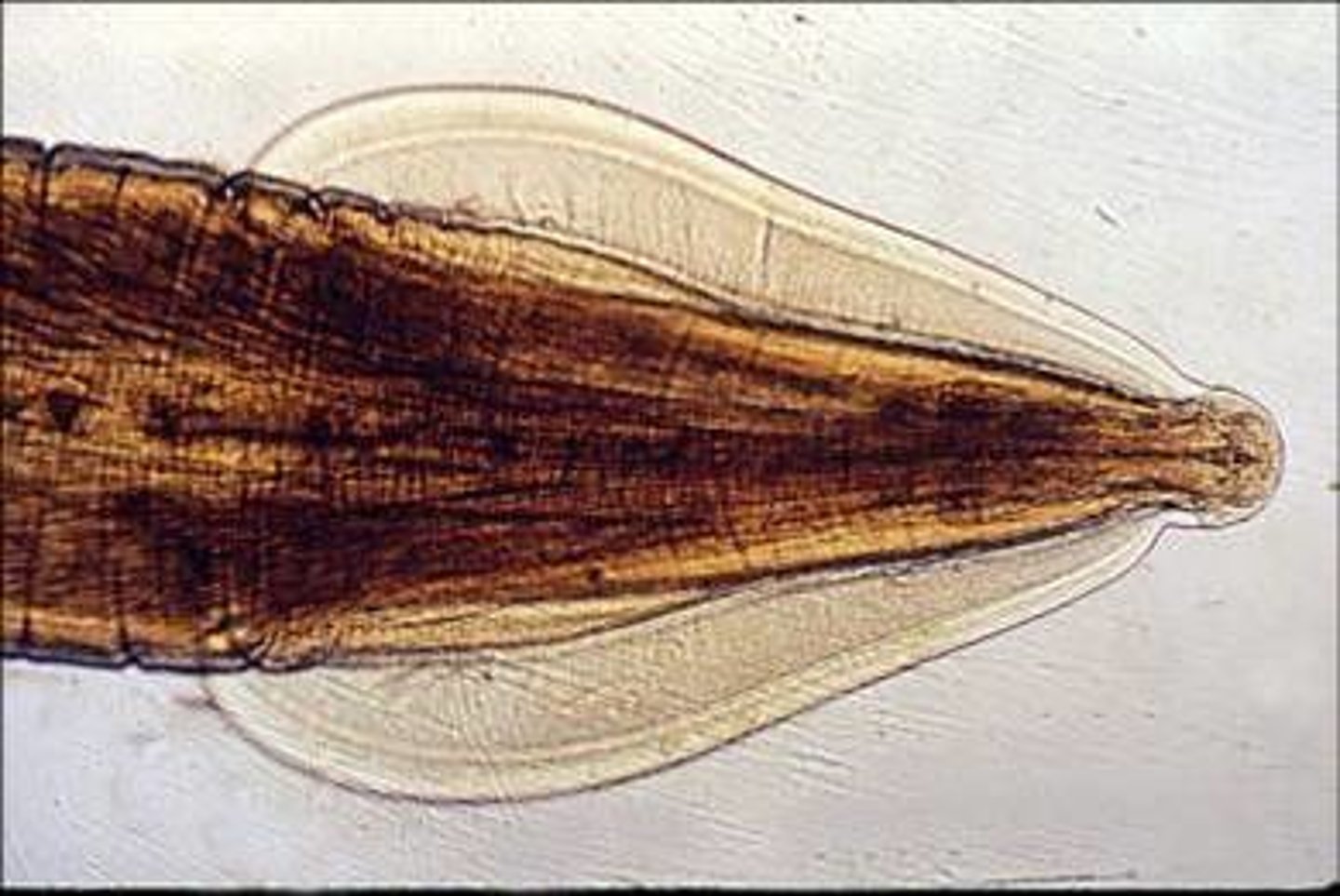 <p>___ alae is at the anterior end</p>