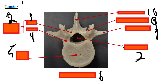 <p>lumbar</p>