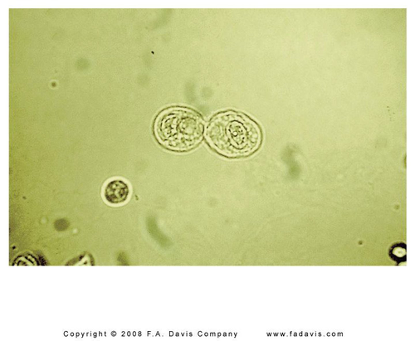 <p>Line the tubules of the nephrons</p><p>Increased numbers associated with tubular necrosis</p>