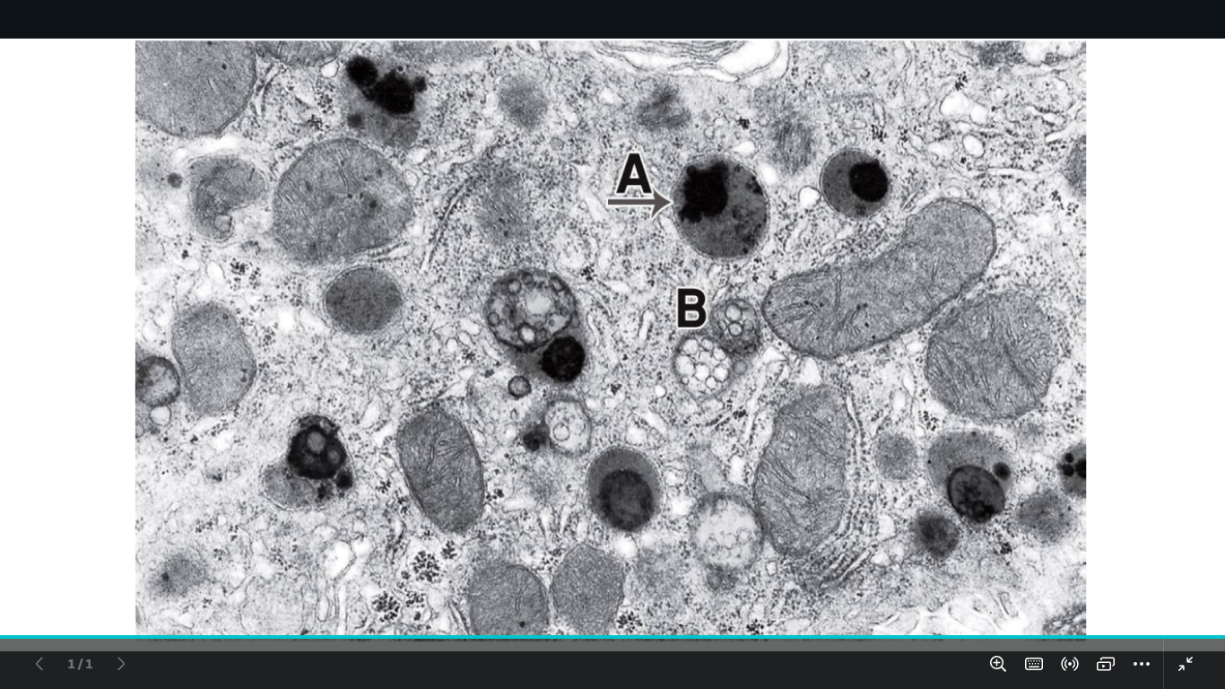 <p>identify a and b</p>