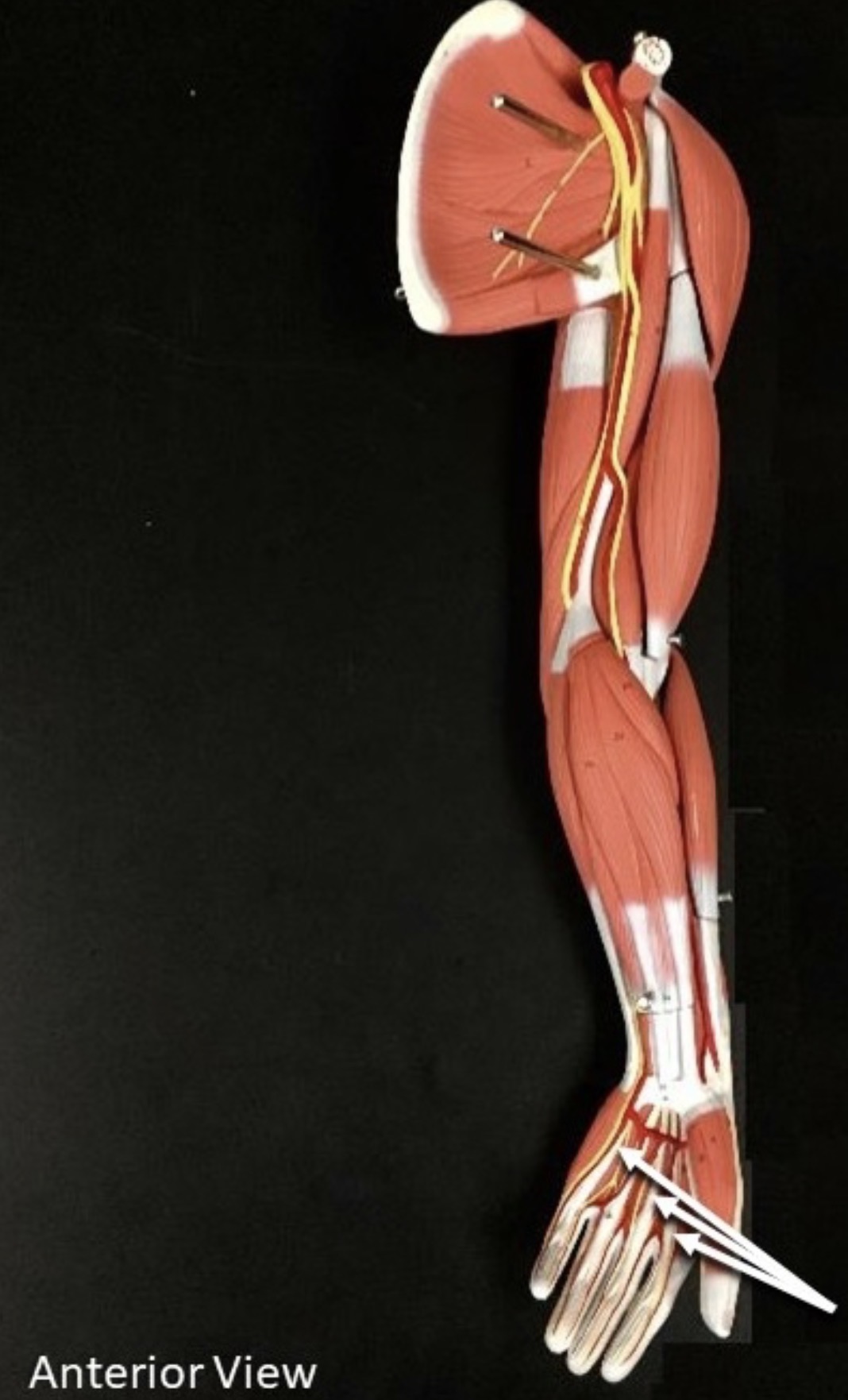 <p><span>Name the structure labeled with the white arrows below.</span></p>