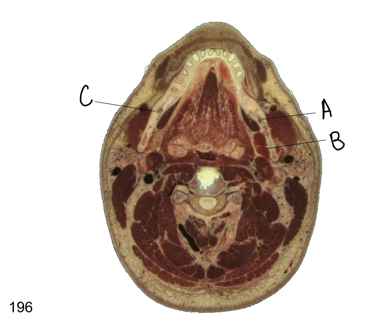 <p>what structures are labeled A and C?</p>
