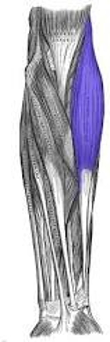 <p>anterior brachial region</p>