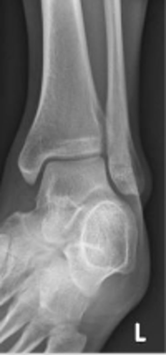 <p>What is the name of the radiographic view?</p>