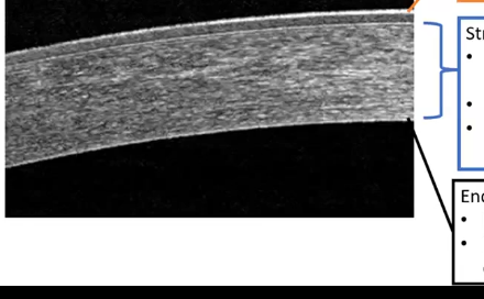 <p>corneal endothelium</p>