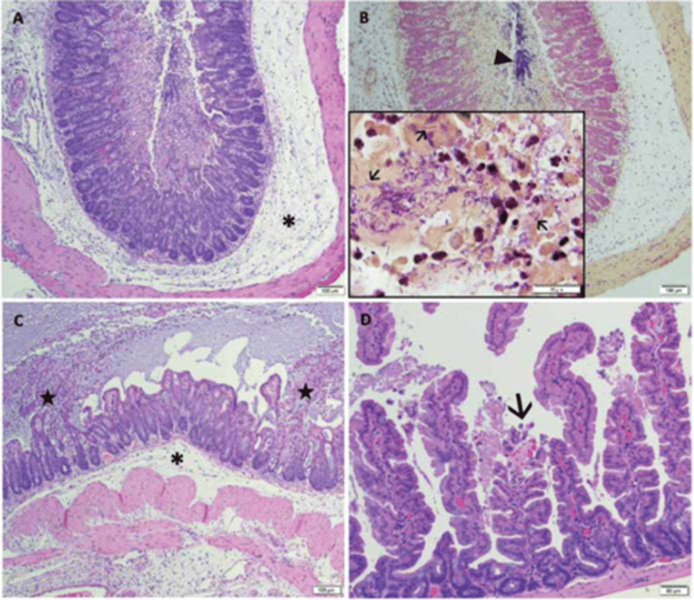<p>These images are histologic lesions consistent with Clostridiodies difficile in mice. What do the stars (not asterisk) represent in image C?</p>