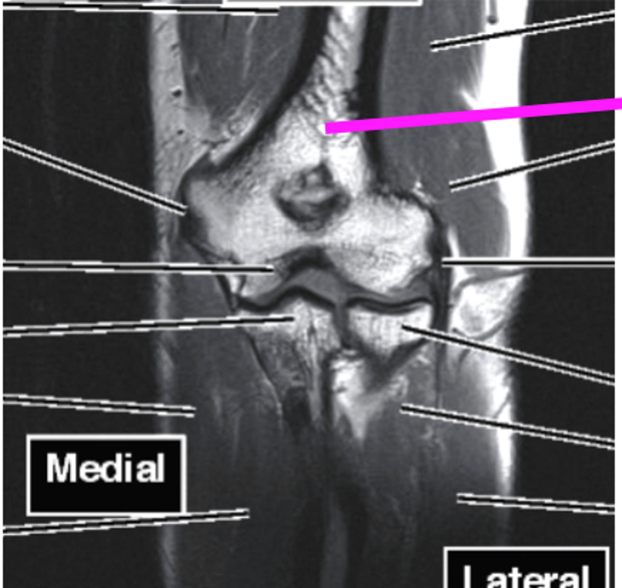 <p>what does this pink line point to?</p>