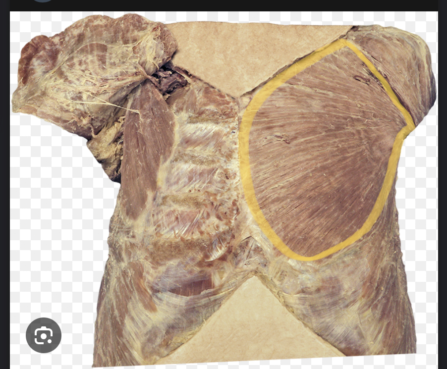 <p>Identify the highlighted muscle</p>